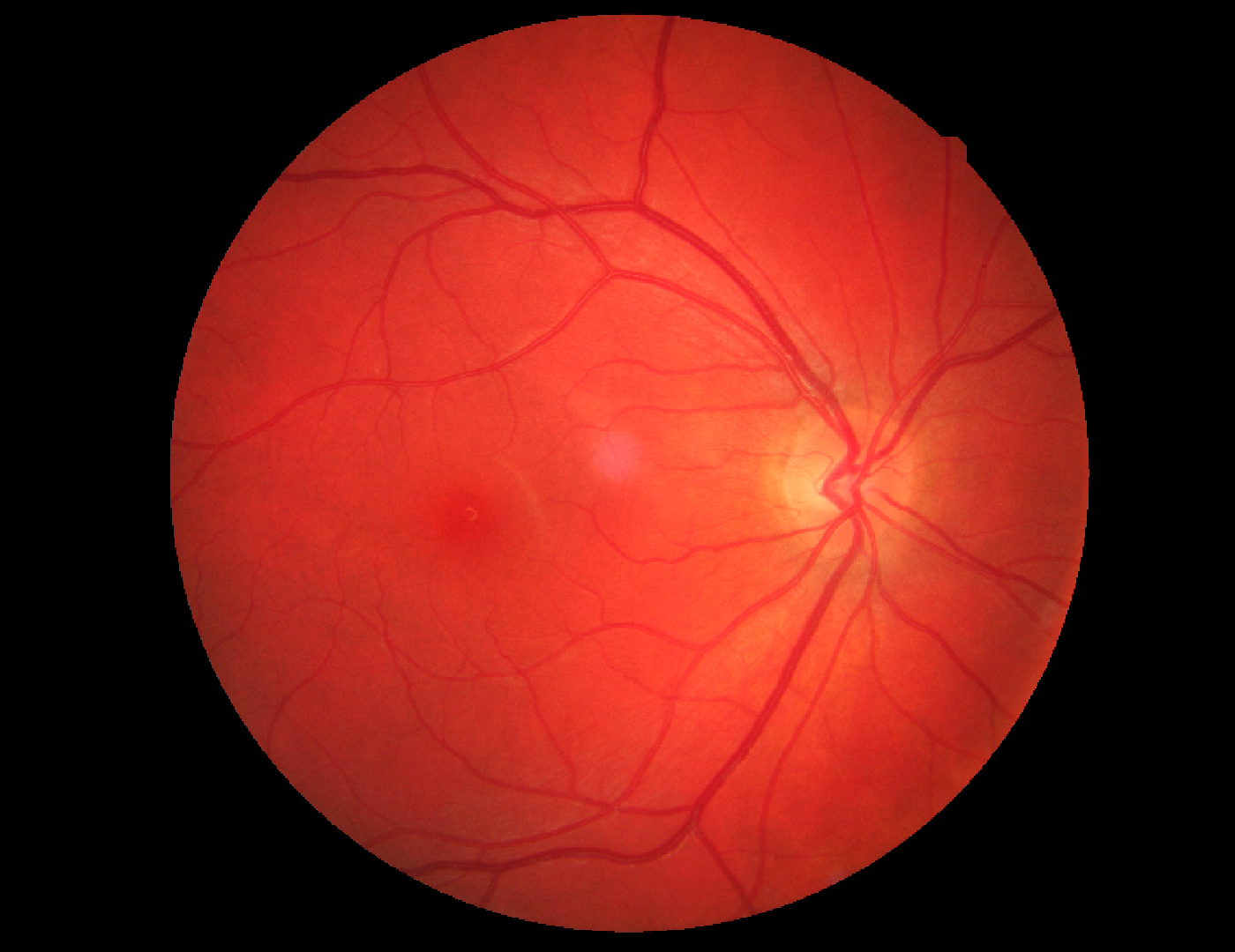 Fundus-Fotografie Fundus-Fotografie